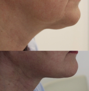 B46955E1-B78E-45BC-A324-0569C70BED8B-293x300